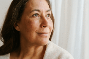 Leia mais sobre o artigo Como Clarear Melasma: O Guia de Ativos e Tratamentos que Realmente Funcionam